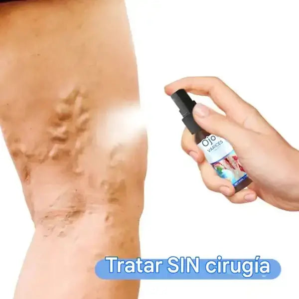 Spray Oveallgo™ para Venas Varicosas – Alivio y Belleza