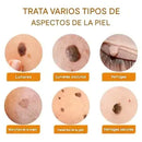 Spray Removedor de Verrugas y Manchas
