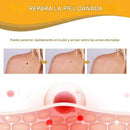 Spray Removedor de Verrugas y Manchas