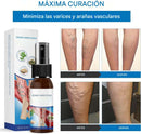 Spray Oveallgo™ para Venas Varicosas – Alivio y Belleza