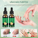Sérum de Uñas de Jengibre™ – Fortalece y Elimina Hongos
