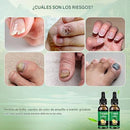 Sérum de Uñas de Jengibre™ – Fortalece y Elimina Hongos