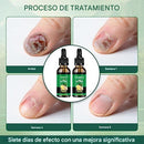 Sérum de Uñas de Jengibre™ – Fortalece y Elimina Hongos