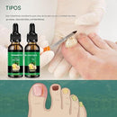 Sérum de Uñas de Jengibre™ – Fortalece y Elimina Hongos