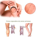 Spray Oveallgo™ para Venas Varicosas – Alivio y Belleza