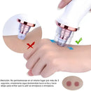 Removedor de Cravos Profissional a Vácuo – Pele Limpa