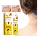 Spray Removedor de Verrugas y Manchas