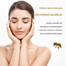 Spray Removedor de Verrugas y Manchas